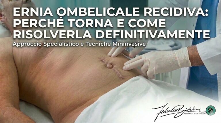 Ernia ombelicale recidiva